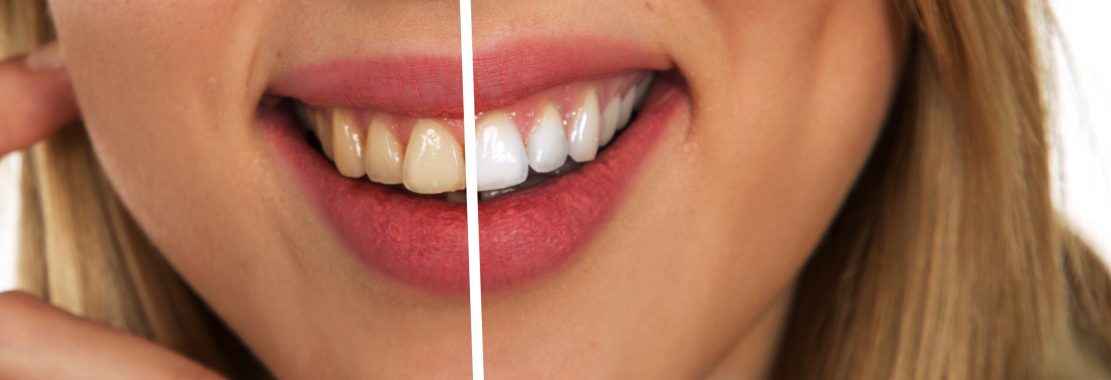 Selling whitening toothpaste will meet growing customer demand