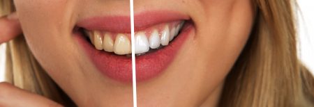 Selling Whitening Toothpaste Online: Opportunities & Tips